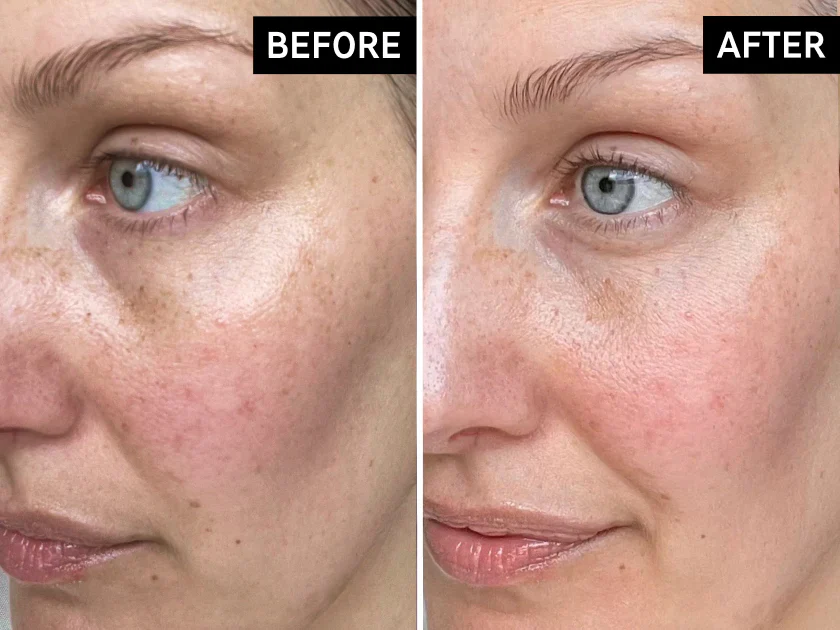Your Best Skin Starts Here